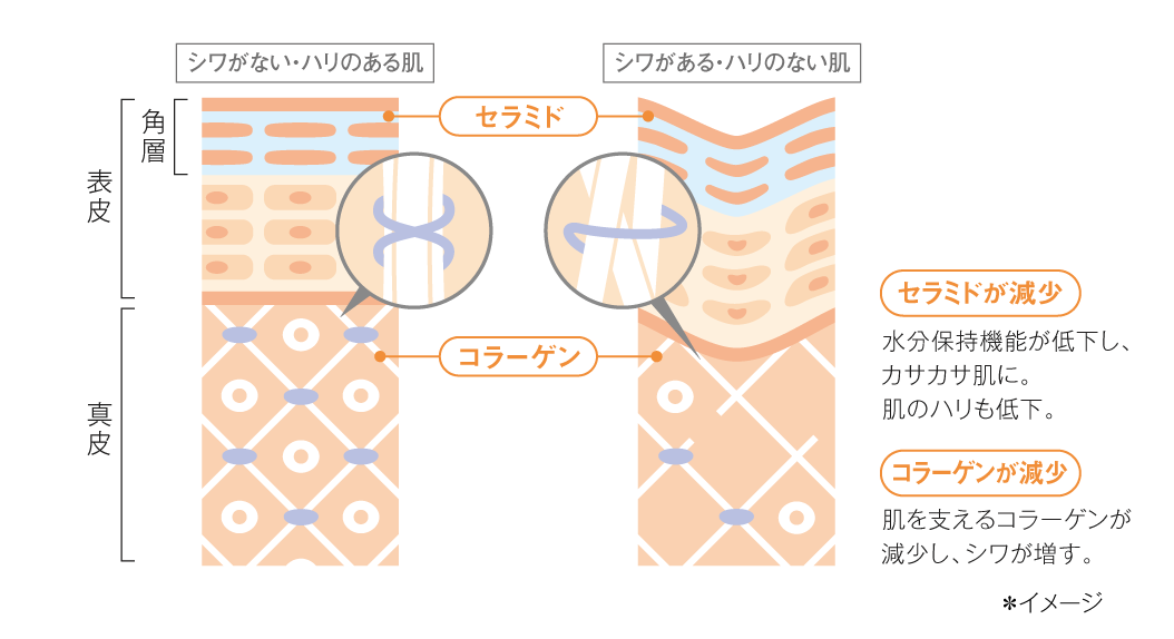 シワのない・ハリのある肌/シワのある・はりのない肌（セラミドが減少・コラーゲンが減少）