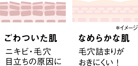 ごわついた肌：ニキビ・毛穴目立ちの原因に なめらかな肌：毛穴詰まりがおきにくい！ *イメージ