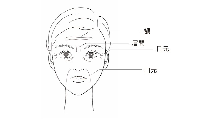 図：顔全体のシワ